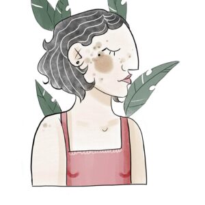 Twój Beauty Plan – Przebarwienia barwnikowe